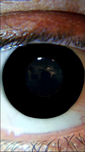 what is the rarest eye color?