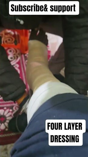 How to Apply a Profore Four-Layer Compression Bandage