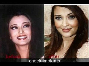 Aishwarya Rai's plastic surgery before and after photos