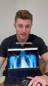 When do we really need X-Rays? 🤔