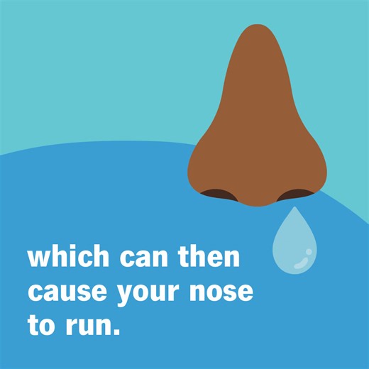 We’ve all dealt with a runny nose at different points in our lives. Sometimes, it’s because we have a cold, the flu or allergies. But sometimes, we might need to break out the tissues because the foods we eat can make our nose turn on like a faucet. Known as gustatory rhinitis, this condition causes a runny nose when you eat certain foods. Think spicy foods like hot peppers, garlic and salsa. If you have gustatory rhinitis, you may experience the following symptoms while you eat: Runny nose. Con