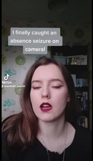 I finally captured one!#absenceseizures #epilepsyawareness