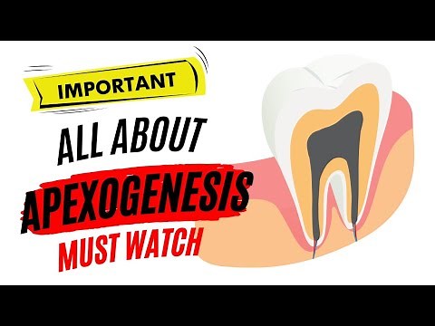 Apexogenesis Versus Apexification