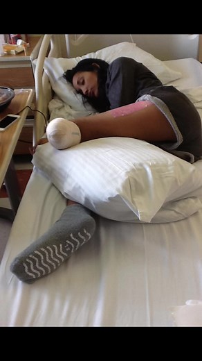 It’s been a long journey but the only thing to focus on is overcoming it all 🦿 🤎 #limbloss #amputee #prostheticleg #mystory #lifesjourney #disabilitytiktok #fyp