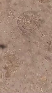 35K views · 426 reactions | Stool sample  #lablife #microbiology | Lab life | Facebook