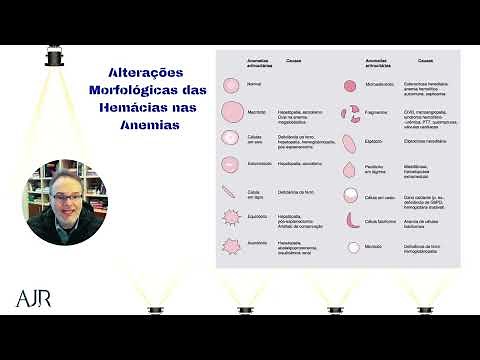 Alterações morfológicas das hemácias nas anemias