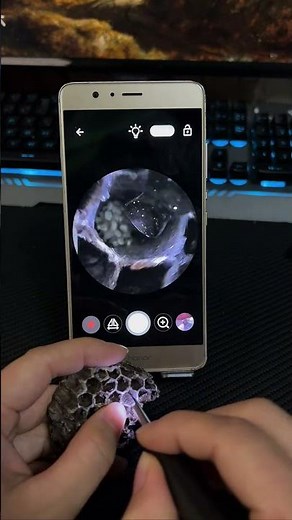 This Visual Ear Cleaner Is Insanely Satisfying! 👂✨ Real-Time Camera View