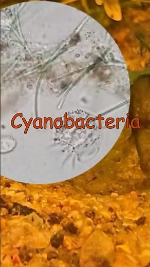 What NASTY BUGS are in AQUARIUMS?!?