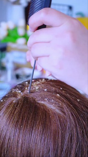 Welcome back to another relaxing session of ASMR hair and scalp check! Today, we will be taking you on a journey of soothing sensations Sit back, relax, and let the ASMR hair and scalp check transport you to a world of serenity and tranquility. Enjoy this soothing experience and let your worries melt away. #asmr #hairasmr #asmrnotalking #scalpcheck #scalpcheckasmr #dandruffasmr #dandruff