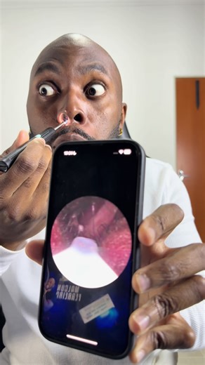 Review da Micro Câmera para Limpeza de Ouvido