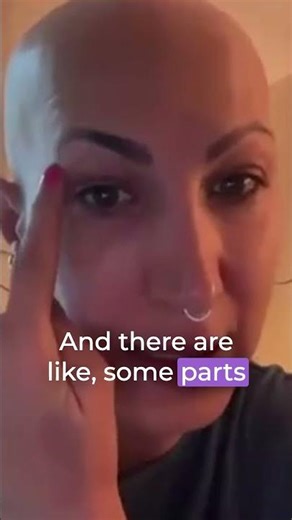 Alopecia Angel restores what hair loss once took away — confidence.