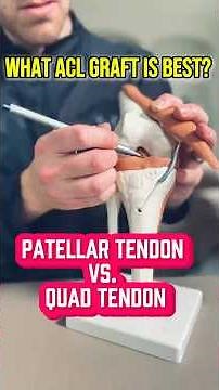 Choosing the Right ACL Graft - Full Breakdown!