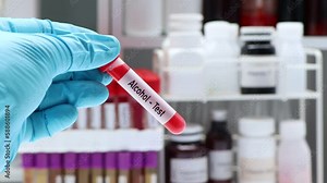 Alcohol test to look for abnormalities from blood, blood sample to analyze in the laboratory, blood in test tube