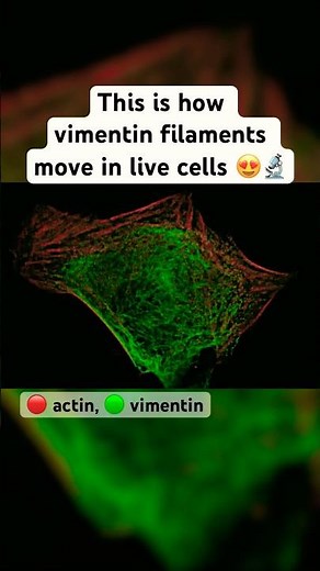 This is how vimentin filaments move in live cells 😍🔬