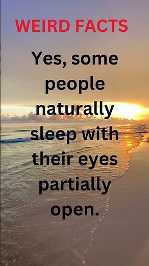 😲 Can You Really Sleep With Your Eyes Open? The Weird Truth!