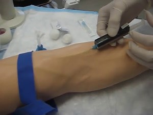 Injection intraveineuse avec gaine