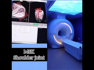 MRI Shoulder joint planning & Positioning on #philips 3T #mri