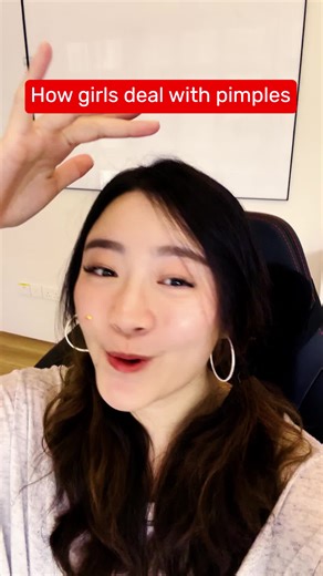 Effective Pimple Relief with Oxy 5 and Oxy 10