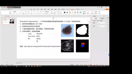 一键完成医学图像分割！这是我研究生期间的部分工作，要毕业了无偿分享给大家，科研必备