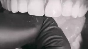 10K views · 222 reactions | Tips & Tricks #Dentistry #LearningTips #BitesnBraces #smile #medical #People #dentista #Tooth #Implant #Dental #orthodontics #prosthodontics #operativedentistry | Bites & Braces Dental | Facebook