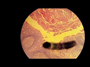 histology of the Appendix