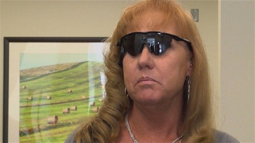 Blind Woman Gets 'Amazing' Sight of Son With Bionic Eye