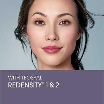 Teoxane Redensity Filler