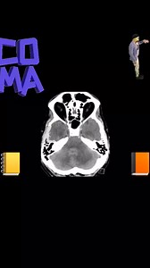 13K views · 145 reactions | Neurological examination #brain #neurology | Neurology | Facebook