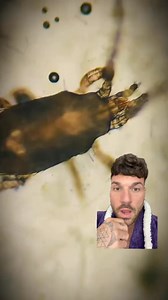 cheetos under a high power microscope 😳 #parasites #bugs | Conscious media 369