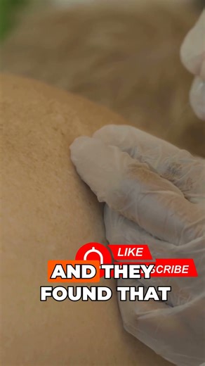 Trochanteric Bursitis/GTPS: Reconsidering Corticosteroid Injections! #shorts