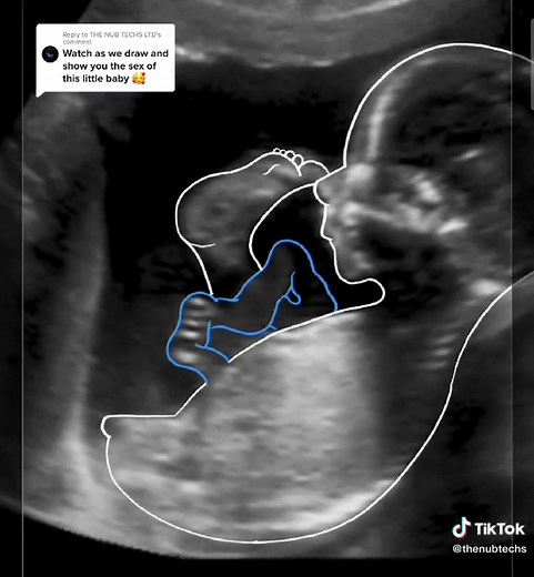 Gender Reveal: Nub Theory Drawing Explained | NubTechs