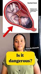 What is a nuchal cord in the womb?#NuchalCord #PregnancyTips #MidwifeChiamaka #AntenatalCare #FBReels | Midwife Chiamaka
