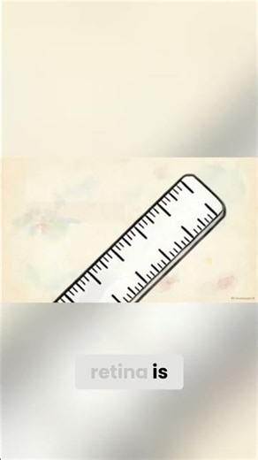 The Genius Engineering Inside the Da Vinci Surgical Robot