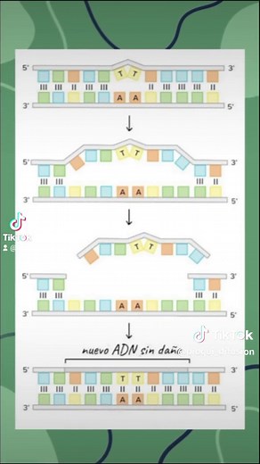 Judith Alonzo y Mariana Cuadras_Xeroderma Pigmentoso