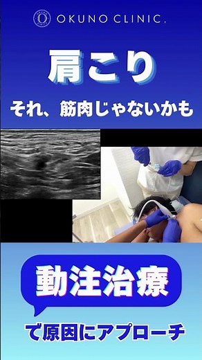 【しつこい肩こり】マッサージを繰り返しても治らない理由と、動注治療という解決策｜オクノクリニック