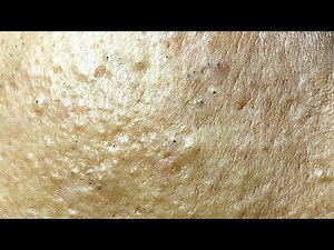 Relax Every Day With Sac Dep Spa #0094