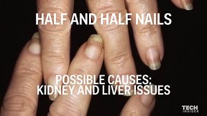12K views · 60K shares | What doctors can tell about your health just by looking at your nails. | Insider Tech | Facebook