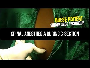 Spinal Anesthesia During C-Section in Obese Patients | Step by Step Guide