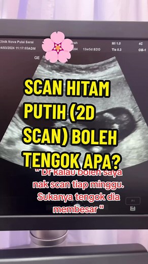 Understanding 2D Scan: Monitoring Baby's Development