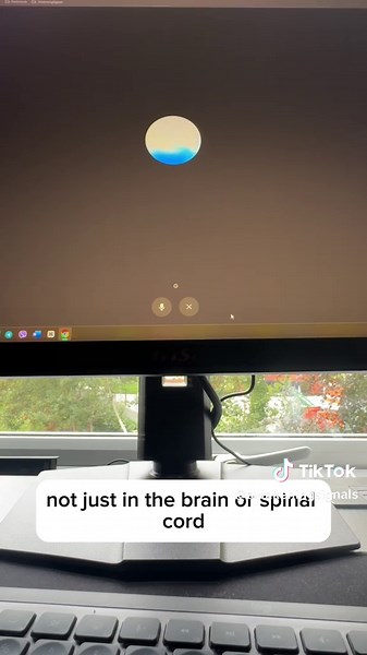 Understanding Multiple Sclerosis: Hidden Causes and Healing