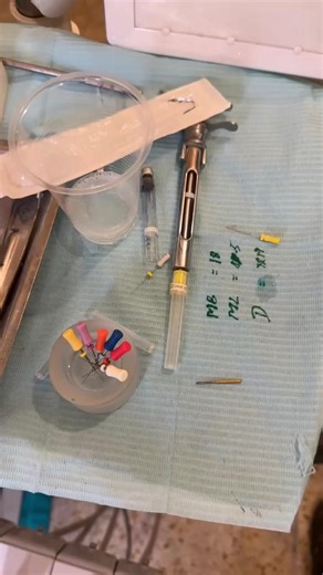 Lower 6 Access and Pulpectomy Procedure Explained