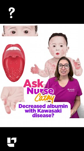 Cathy answers a question from YouTube posted by @Last_Order14