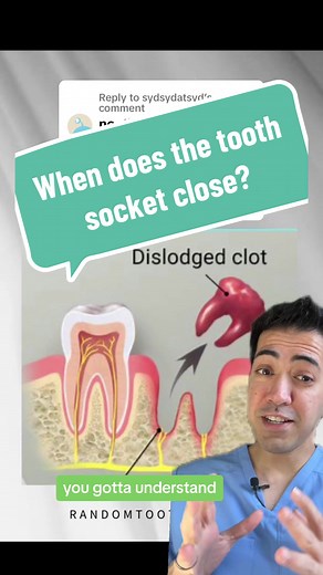 Understanding the Healing Process After Tooth Extraction