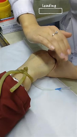 The Precision of Intravenous Care. . . This video provides an up-close look at the intravenous (IV) infusion process, a fundamental yet highly demanding part of daily hospital life. It highlights the calm, steady hand required to manage medical equipment and patient care simultaneously. Beyond the medicine being delivered, the scene captures the technical focus and rhythmic nature of nursing. Successfully managing an IV line isn't just about the insertion; it involves constant monitoring and ens