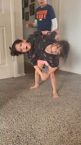 I’m raising conjoined twin girls | seen.tv