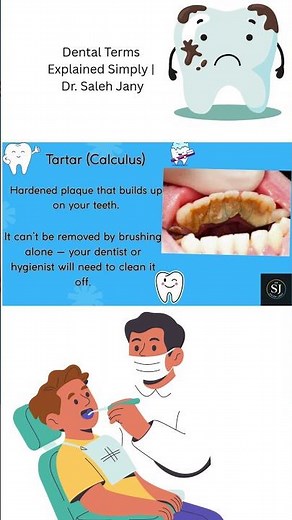 Dental terms calculus
