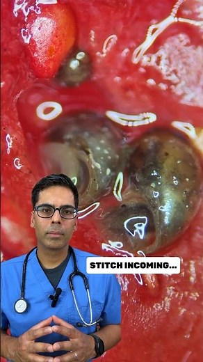 Doctor Sethi Explains A Kitchen Hack For Washing Your Fruits And Veggies 🚀