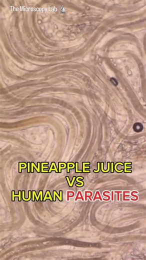 The Microscopy Lab on Instagram: "PINEAPPLE 🍍 JUICE VS HUMAN PARASITE THE MICROSCOPY LAB 🔬 . . #pineapple #juice #fruits #fruitlover #reels #lab #microscope #undermicroscope #instagram #instagood #amazing"