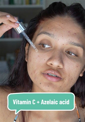 For anyone dealing with active acne AND the marks at the same time, this is how I use vitamin C 15% azelaic acid in the same routine. 🤍 @IUNIK beta glucan serum @Eqqualberry vitamin illuminating serum @PURITO SEOUL moisturizer #acneproneskin #azelaicacid #vitaminc #acnemarks #adultacne