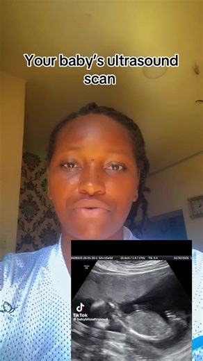 Your Baby's Ultrasound Scan: What to Expect